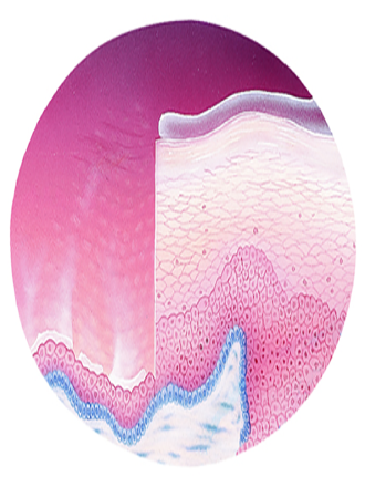 Changes in the vaginal epithelium with menopause. Reproductive years on the right; menopause on the left